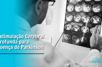 Estimulação Cerebral Profunda para Doença de Parkinson