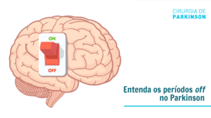 Como a doença de Parkinson se espalha no cérebro? - Blog Cirurgia