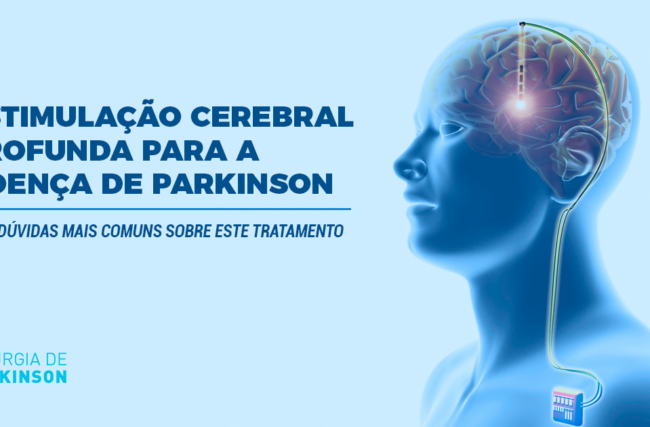 Estimulação Cerebral Profunda para a Doença de Parkinson – As 7 dúvidas mais comuns sobre este tratamento.