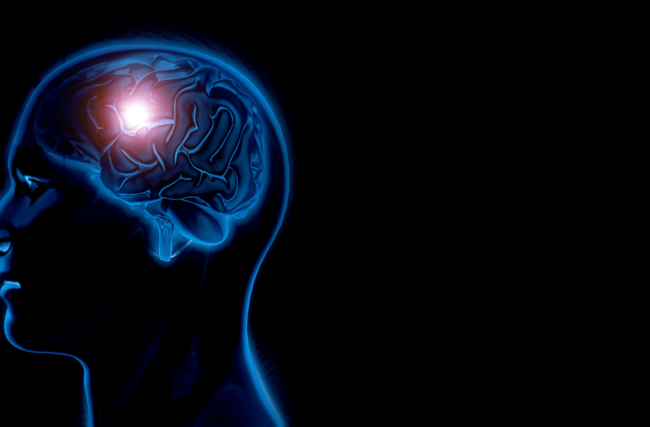 Estimulação Cerebral Profunda: benefícios para pacientes em estágio avançado de Parkinson
