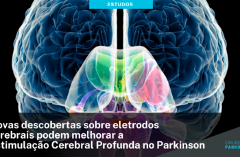 Novas descobertas sobre eletrodos cerebrais podem melhorar a Estimulação Cerebral Profunda no Parkinson